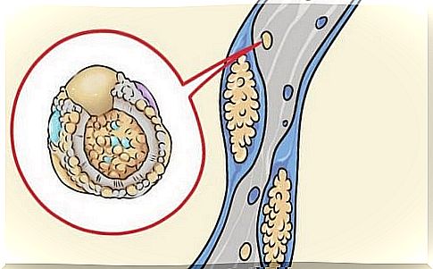 5 foods to cleanse your arteries the natural way