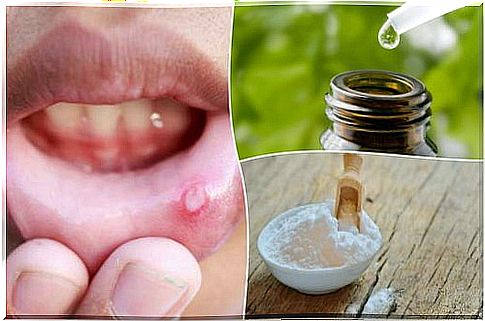 6 natural remedies for blisters in the mouth