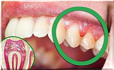 6 possible causes of toothache