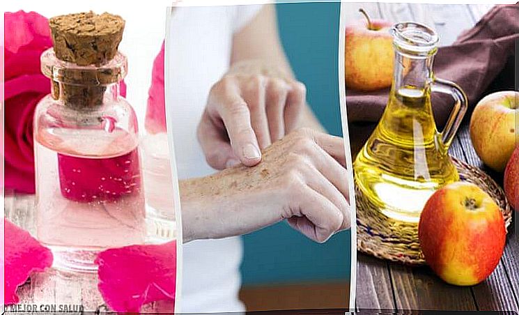 8 mild remedies that can lighten liver spots on the hands