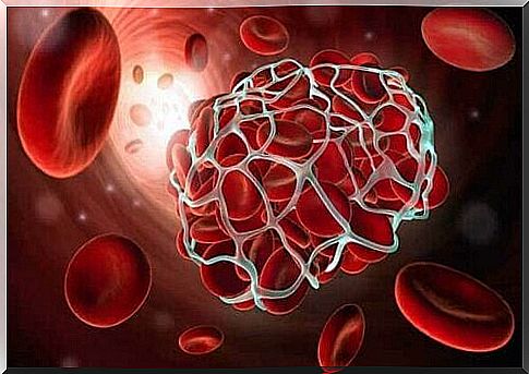 Illustration of blood clot