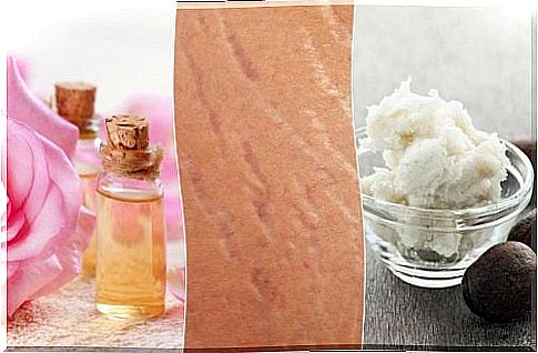 Make stretch marks less visible with 4 natural treatments