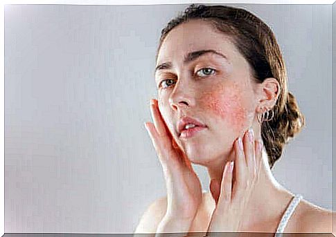 Reactive skin: Symptoms, causes and treatment