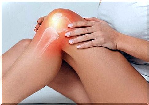 Woman with sprained knee