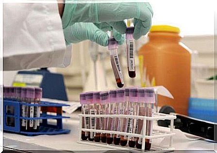 Blood tests as part of eradicating HIV