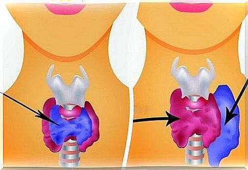 The difference between hypothyroidism and hyperthyroidism