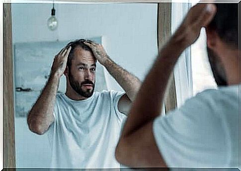 Man with alopecia