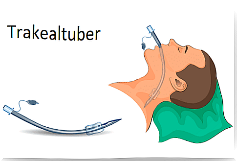 Illustration of the use of tracheal tubes