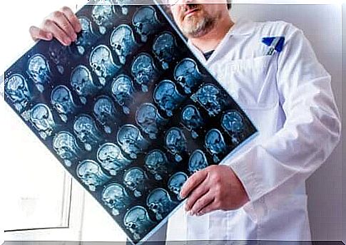 Brain scans can show different types of epilepsy